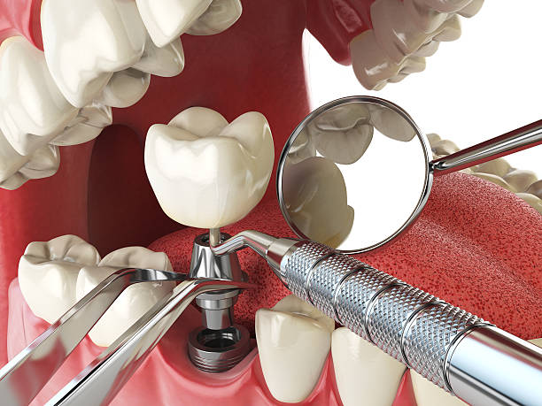 , KS Emergency Dentist Company